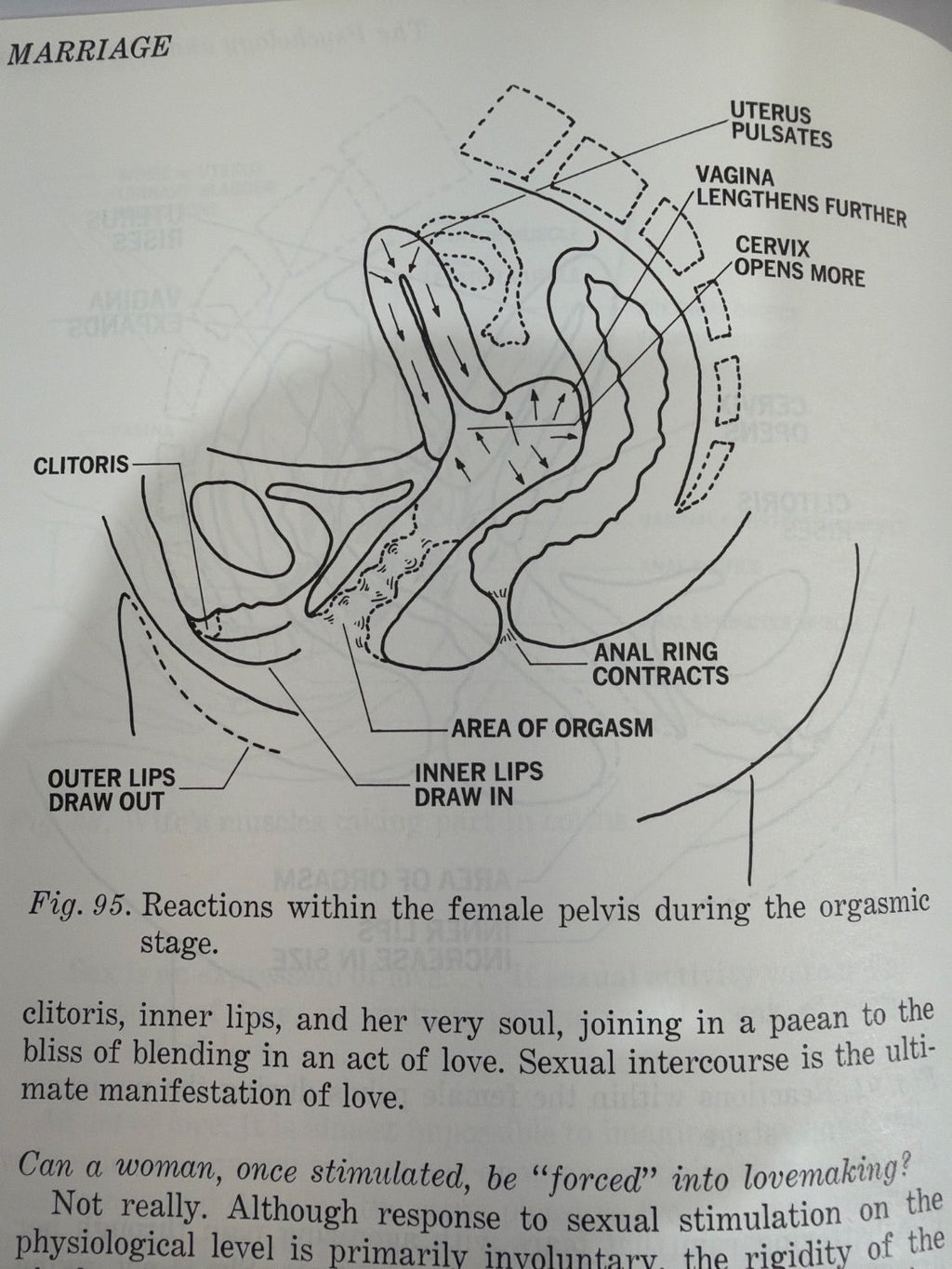 Wendell M. Koble, M.D. and Richard Warren Sex in Marriage Hardcover 1970s